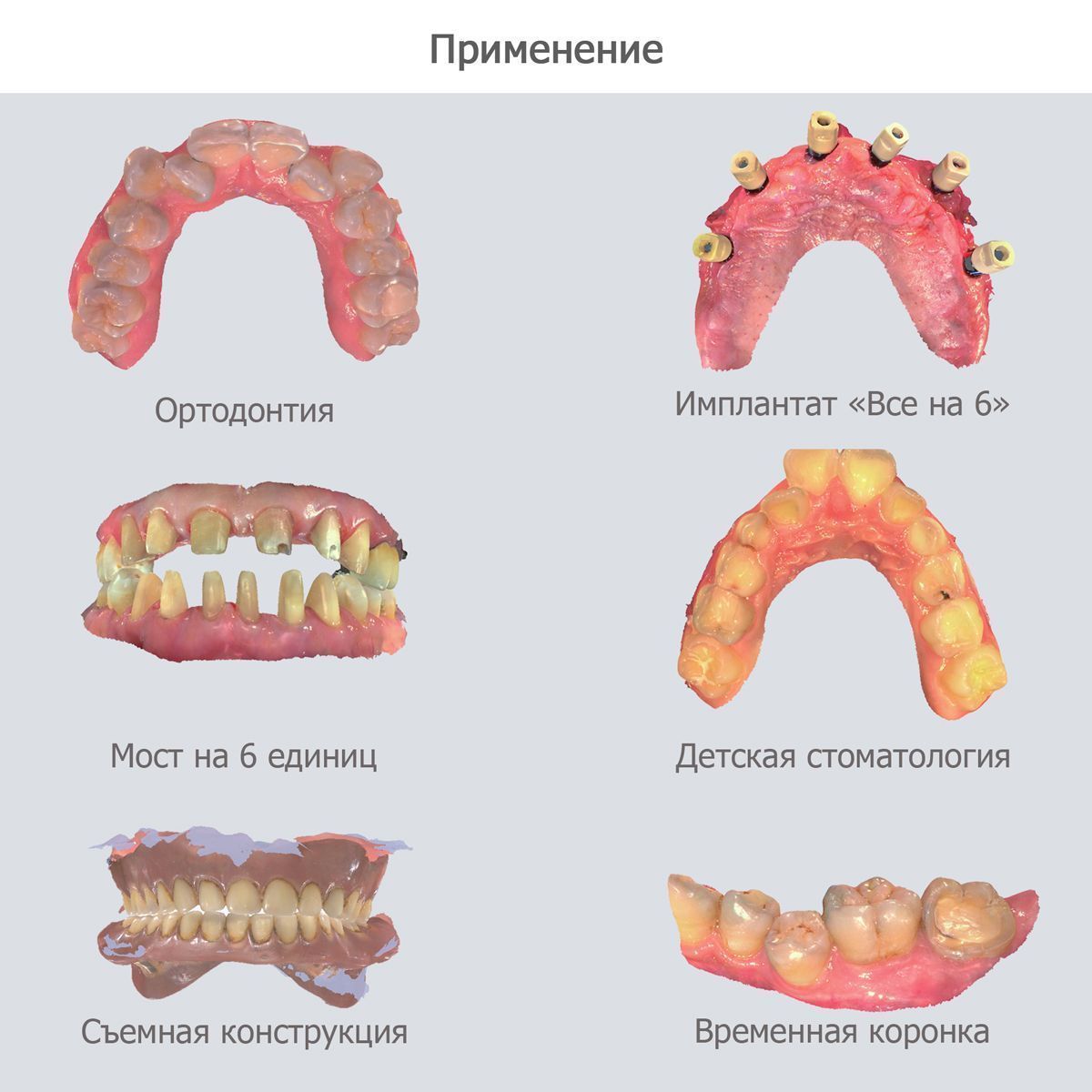  Интраоральный сканер Shining 3D Aoralscan 3 | SHINING 3D в интернет-магазине dialog.dental