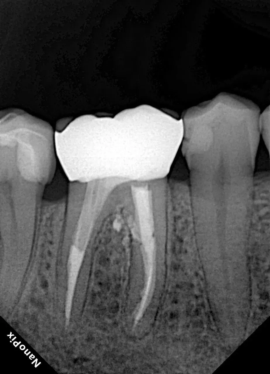  Визиограф NANOPIX с искусственным интеллектом (Nano AI) | Eighteeth в интернет-магазине dialog.dental
