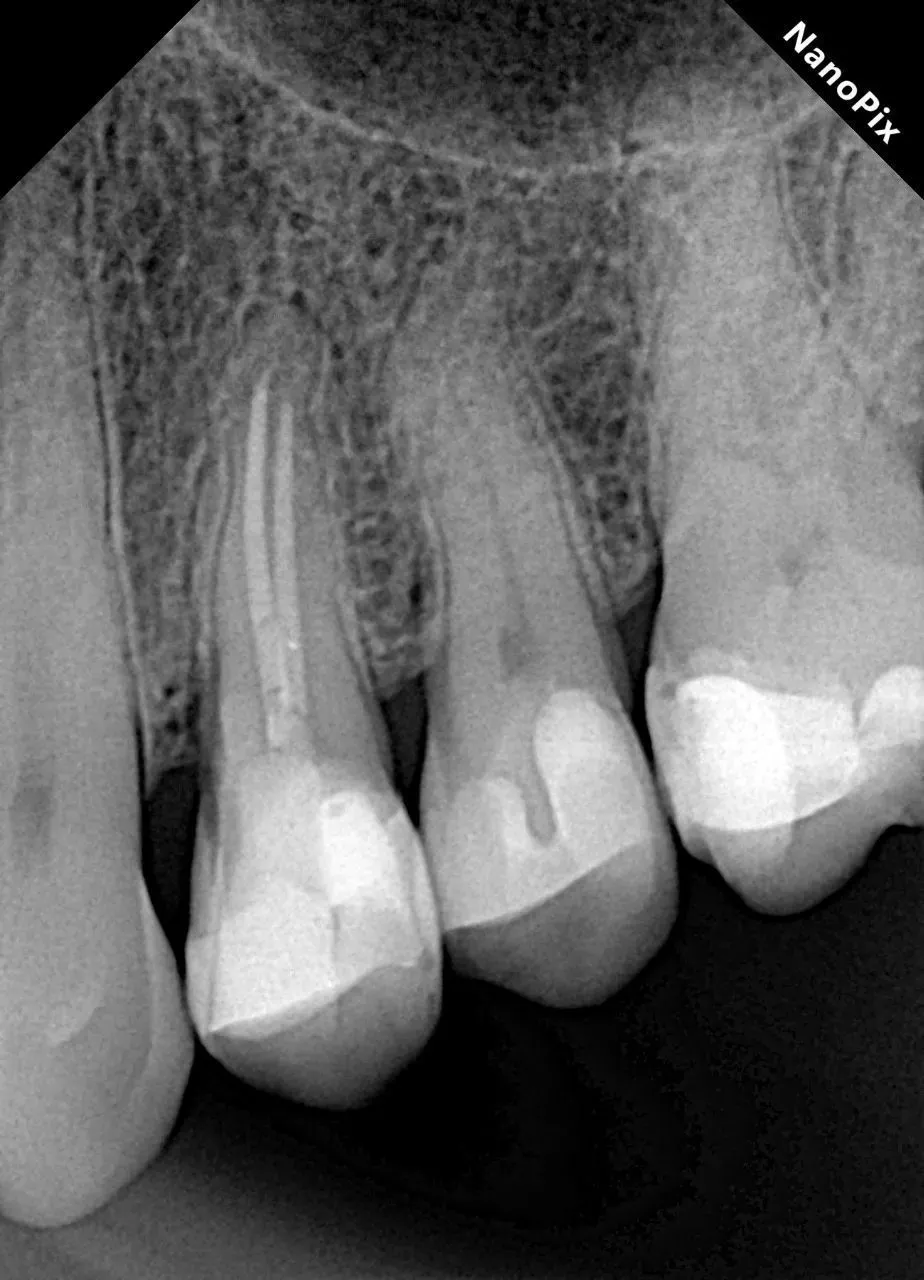  Визиограф NANOPIX с искусственным интеллектом (Nano AI) | Eighteeth в интернет-магазине dialog.dental