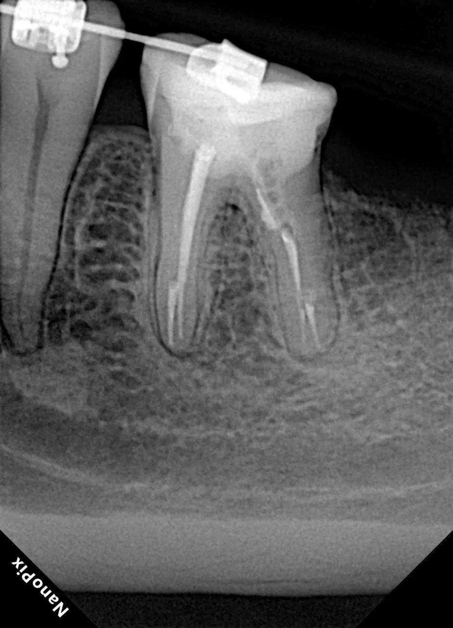  Визиограф NANOPIX с искусственным интеллектом (Nano AI) | Eighteeth в интернет-магазине dialog.dental