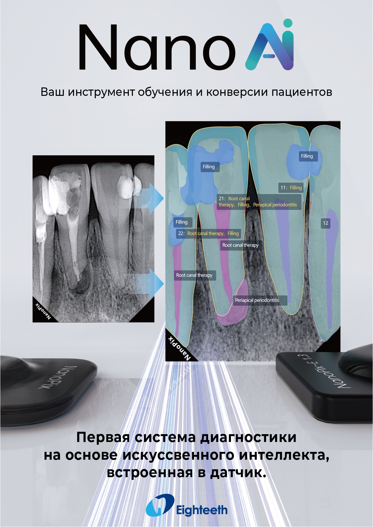 Заказать Визиограф NANOPIX с искусственным интеллектом (Nano AI) | Eighteeth в интернет-магазине dialog.dental