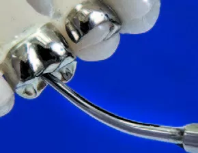 Заказать Насадка для скалера #5AE | Acteon в интернет-магазине dialog.dental