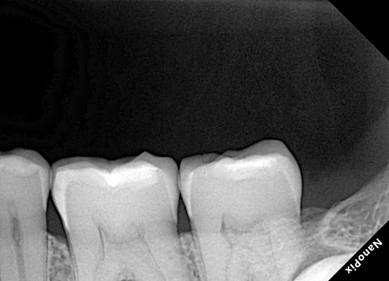  Визиограф NANOPIX с искусственным интеллектом (Nano AI) | Eighteeth в интернет-магазине dialog.dental