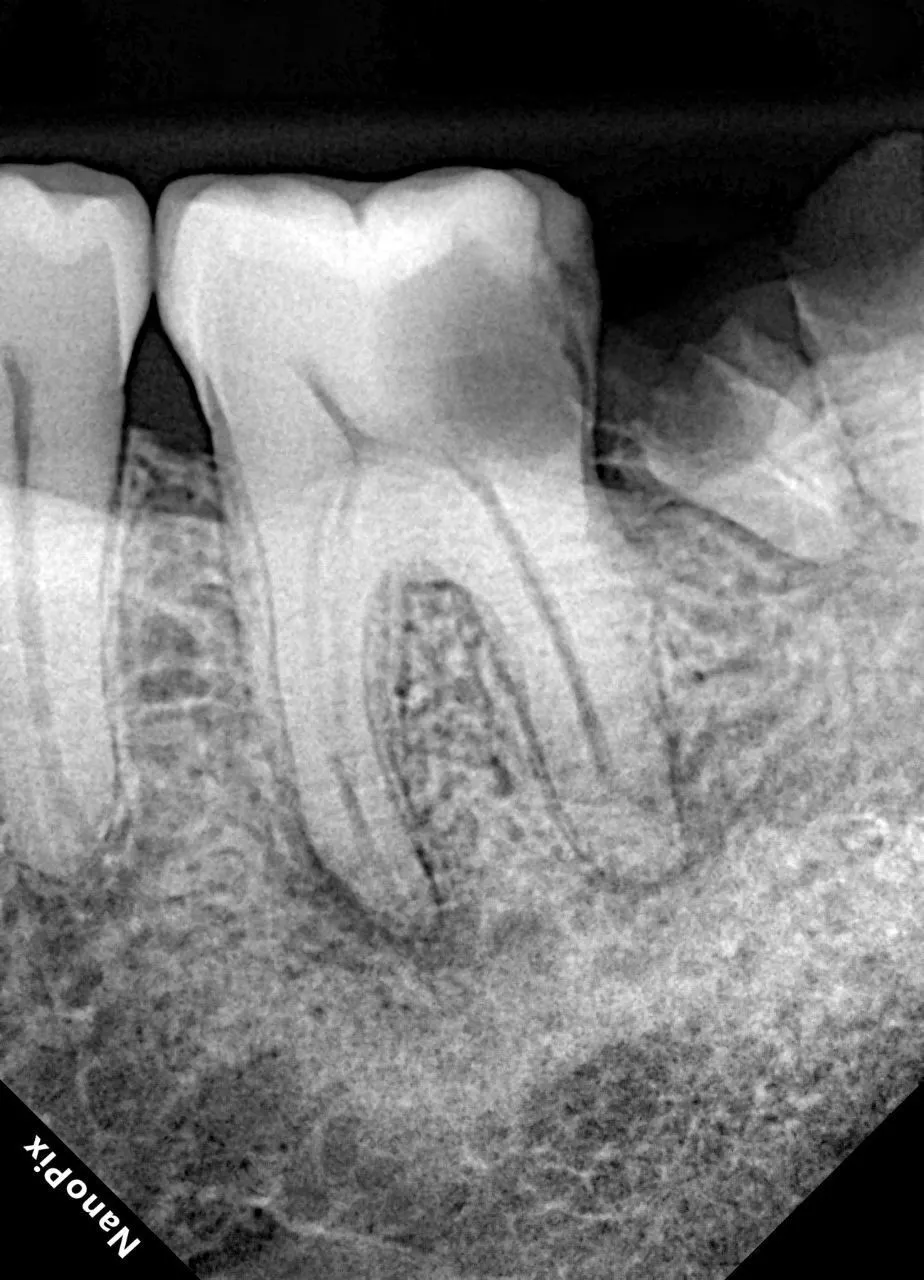  Визиограф NANOPIX с искусственным интеллектом (Nano AI) | Eighteeth в интернет-магазине dialog.dental
