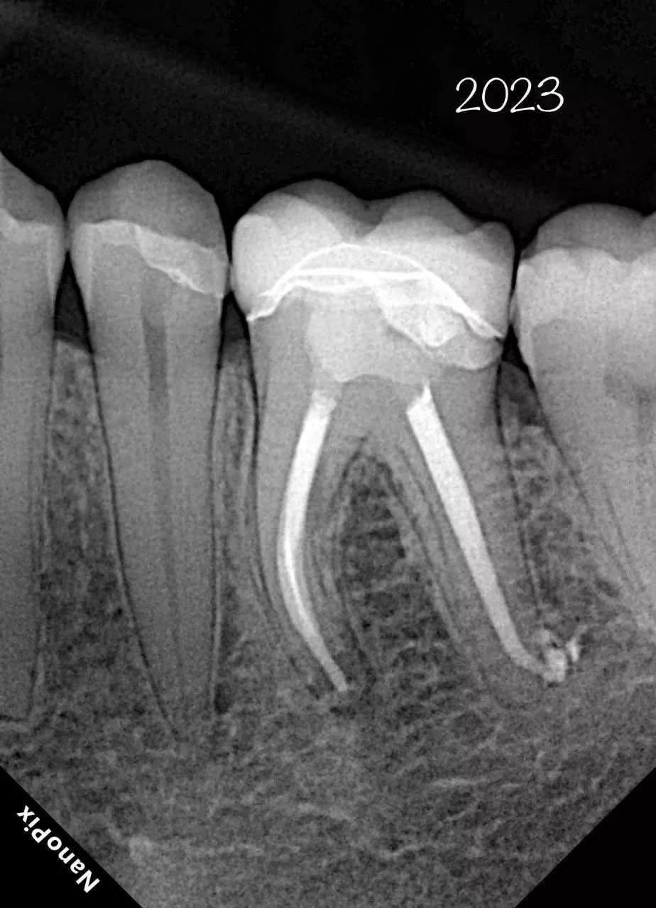  Визиограф NANOPIX с искусственным интеллектом (Nano AI) | Eighteeth в интернет-магазине dialog.dental