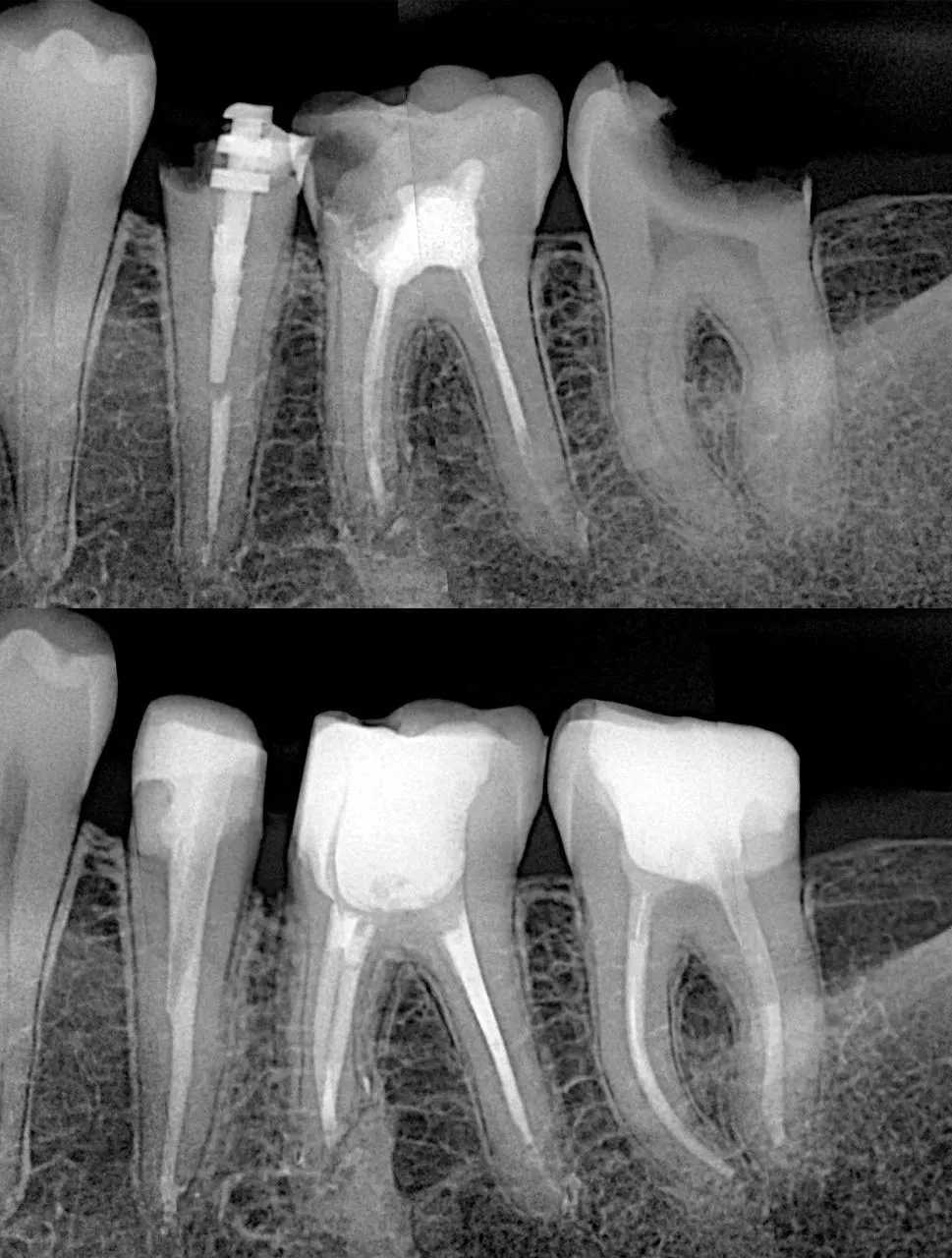 Визиограф NANOPIX с искусственным интеллектом (Nano AI) | Eighteeth в интернет-магазине dialog.dental