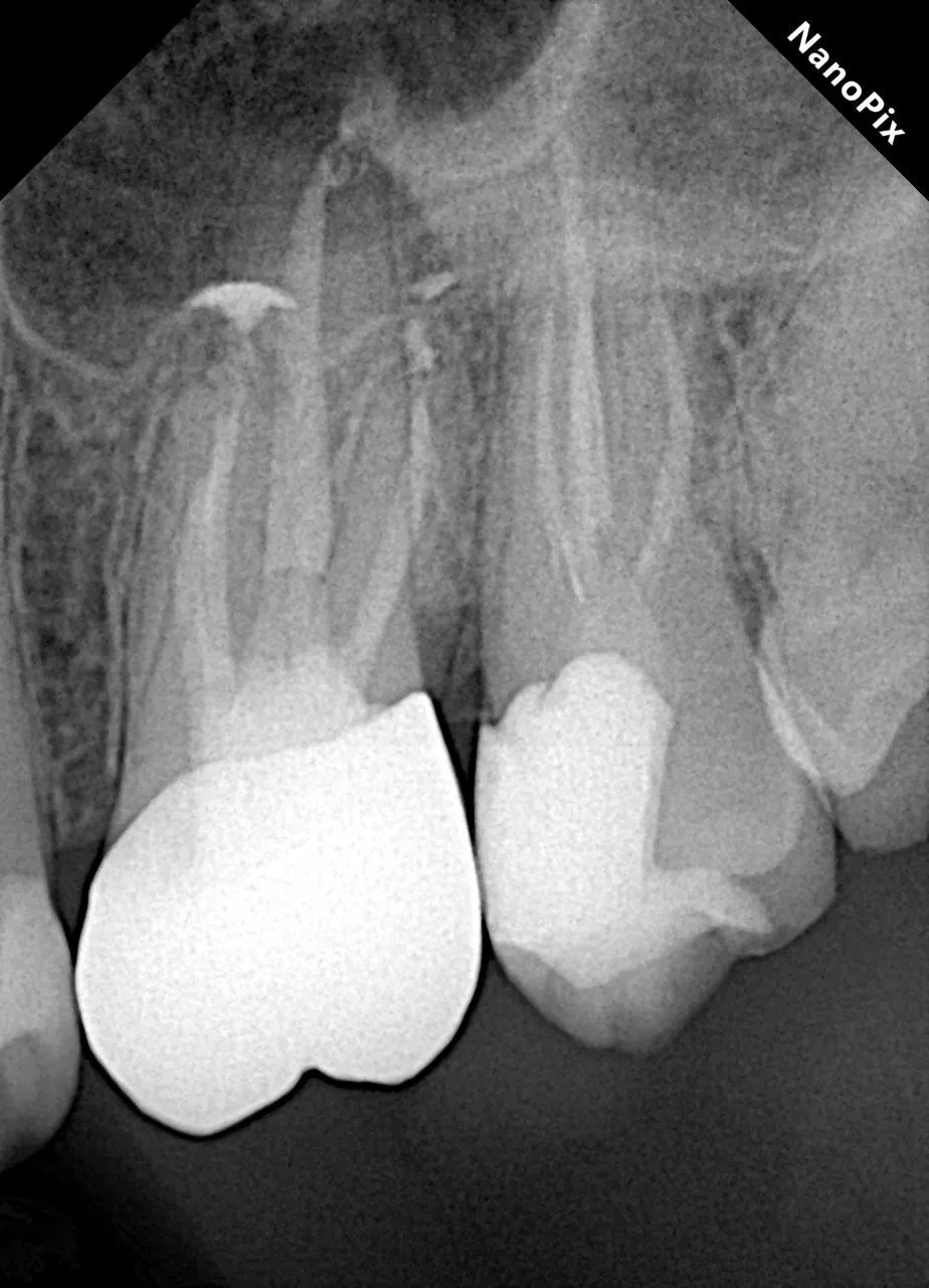  Визиограф NANOPIX с искусственным интеллектом (Nano AI) | Eighteeth в интернет-магазине dialog.dental